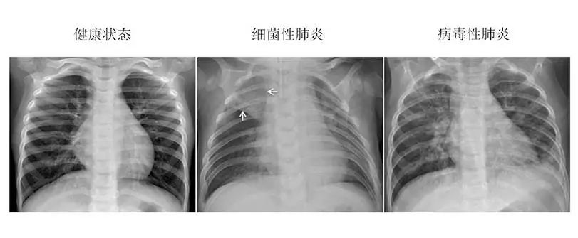 当人工智能遇上医疗！