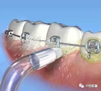 「专利技术」助您保护口腔卫生