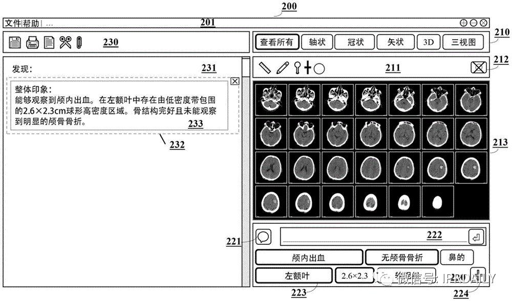 AI赋能医疗影像抗疫