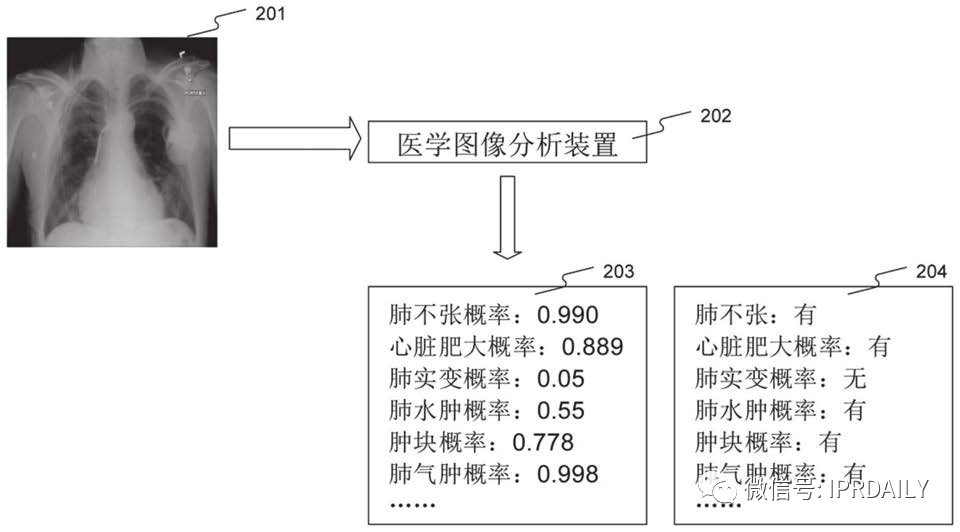 AI赋能医疗影像抗疫